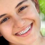 Orthodontie enfant-Centre dentaire Lancy