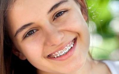 Orthodontie enfant-Centre dentaire Lancy