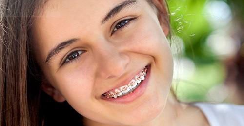 Child Orthodontics - Lancy Dental Centre