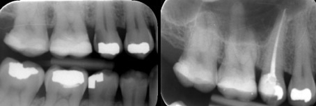 centro odontológico de endodontia