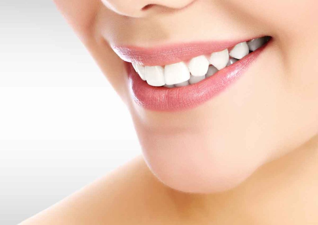Desgaste de dientes y bruxismo- Centro Dental Lancy