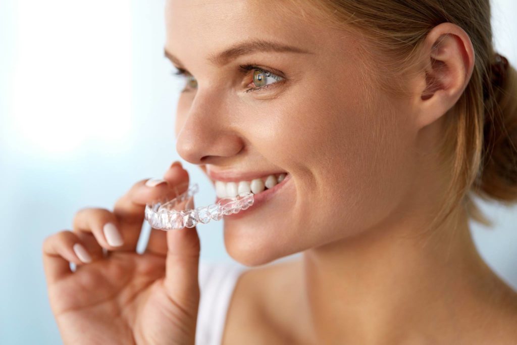 Invisalign in Genf