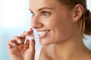 Invisalign en Ginebra