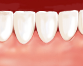 periodontología3-centro dental de lujo