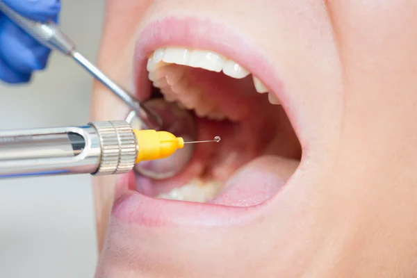 anestesia dentária