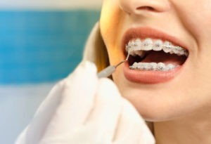 orthodontie