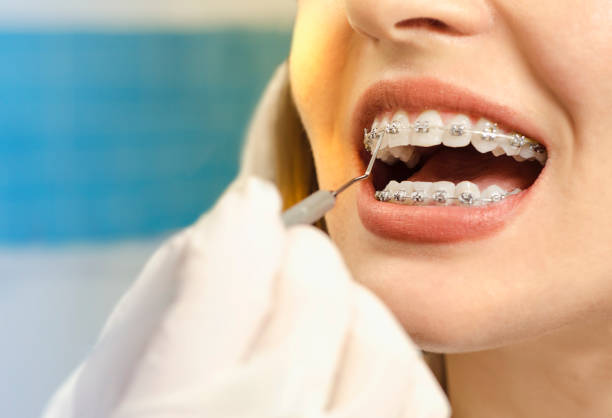 orthodontie