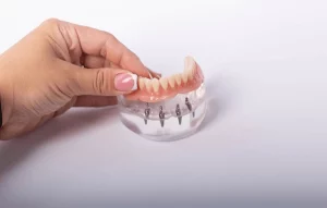 próteses dentárias