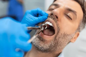 dental surgery